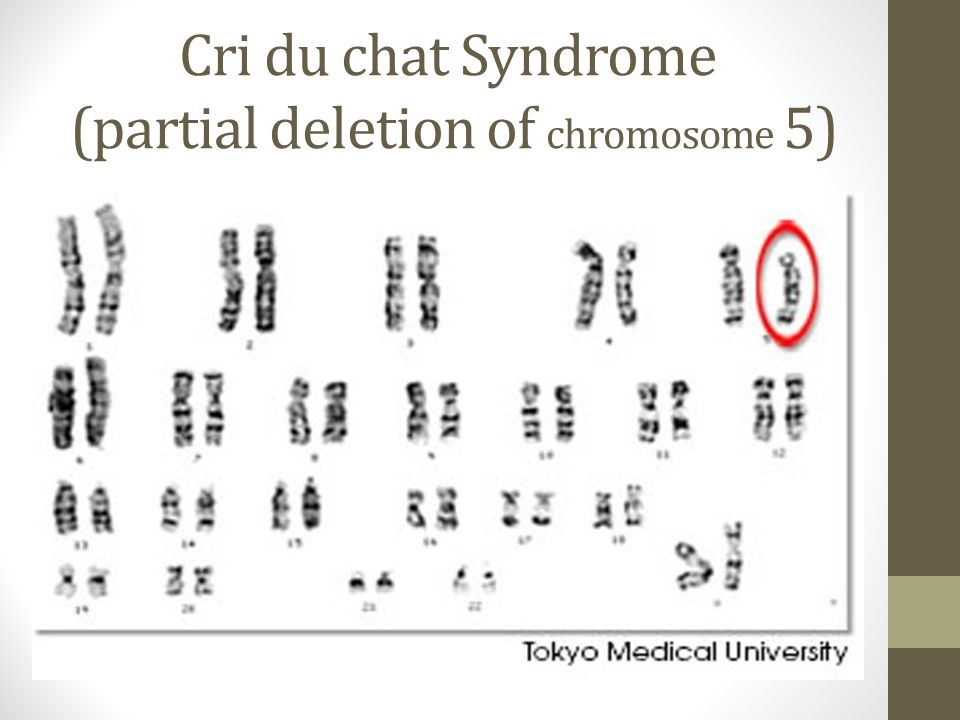 Cri Du Chat Pedigree Chart