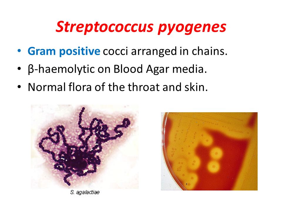 Streptococcus pyogenes.