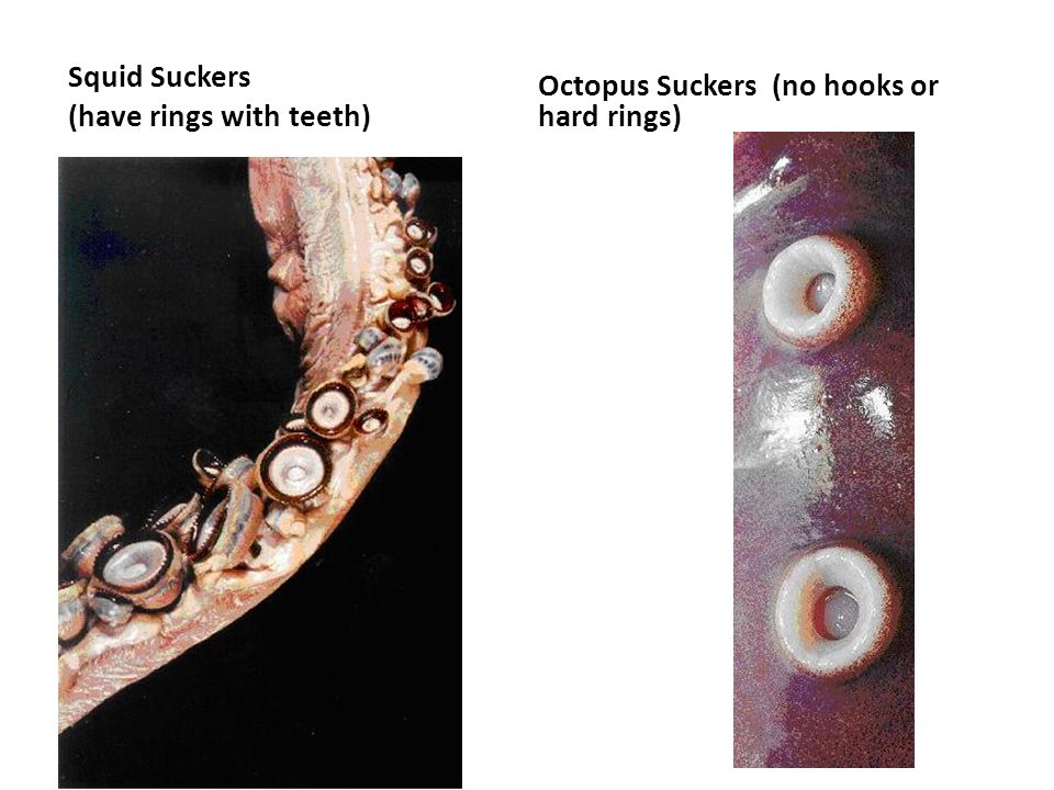Suckers on a squid. Squid Suckers (have rings with teeth)