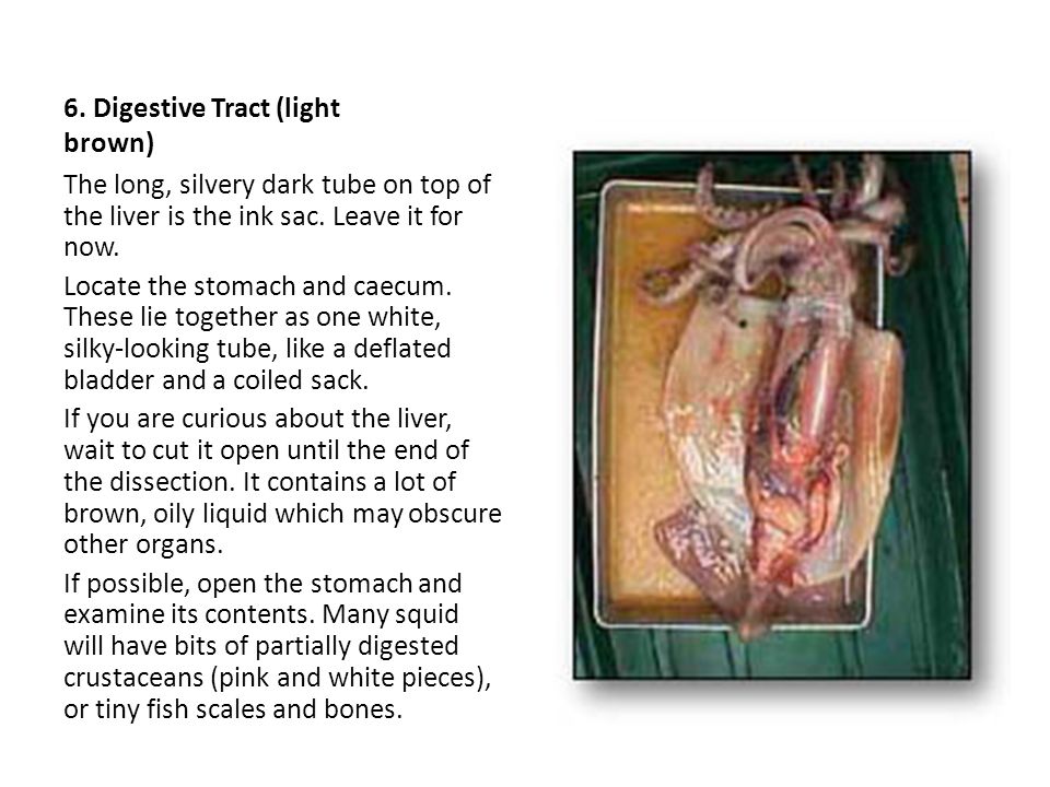 6. Digestive Tract (light brown)