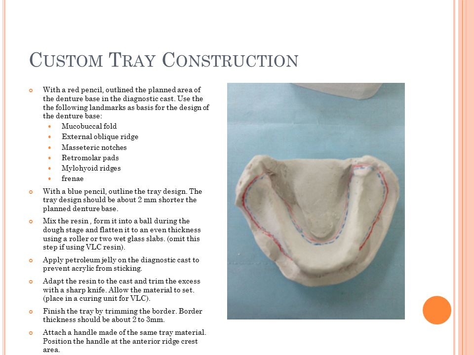 Custom Tray Construction