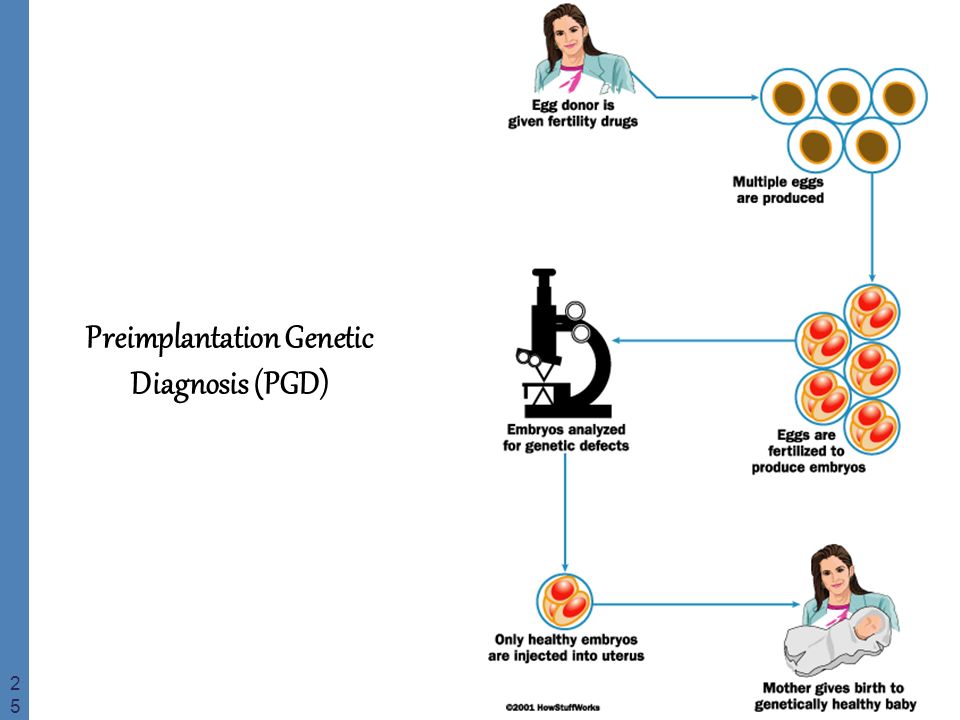 Preimplantation Genetic Diagnosis Pgd