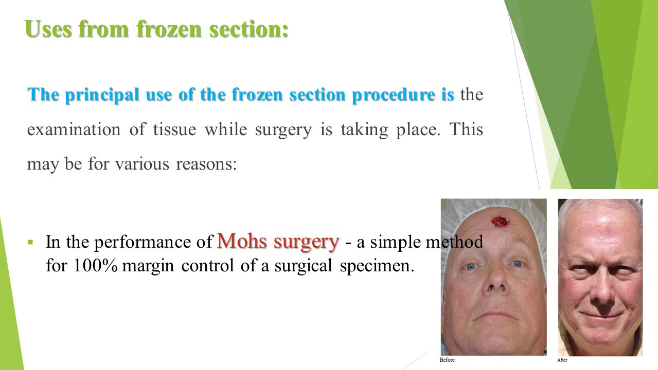 Lab 3: Section Cutting and Frozen Section - ppt video online download