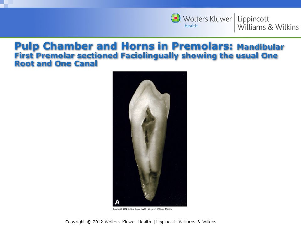 I Internal Pulp Cavity Morphology Related To Endodontic And