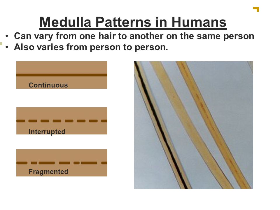 Medulla pattern Medullary Index Width of hair Scale pattern - ppt video  online download