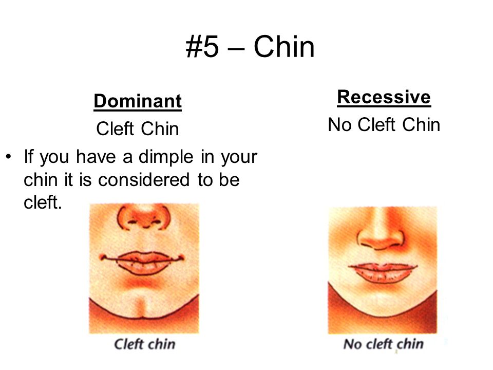 is a cleft chin dominant