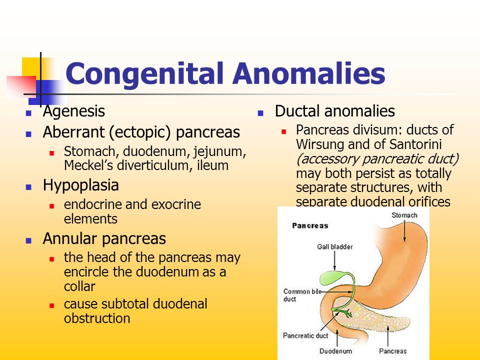 Congenital Anomalies Agenesis Aberrant (ectopic) pancreas Hypoplasia