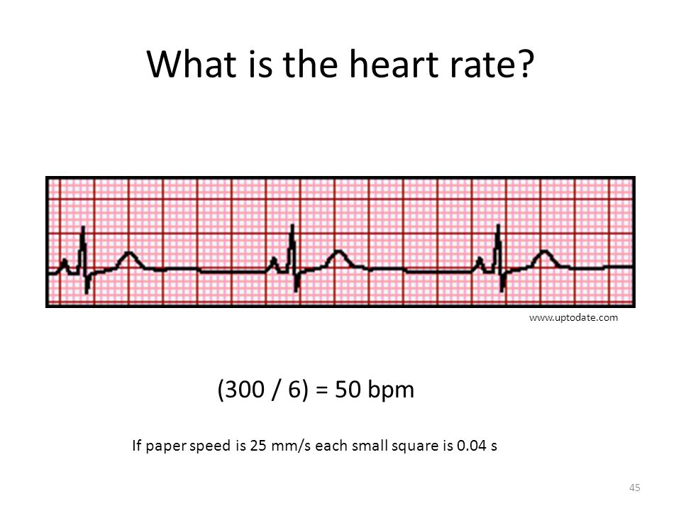 Ecg M Bayat Ph D Ppt Video Online Download