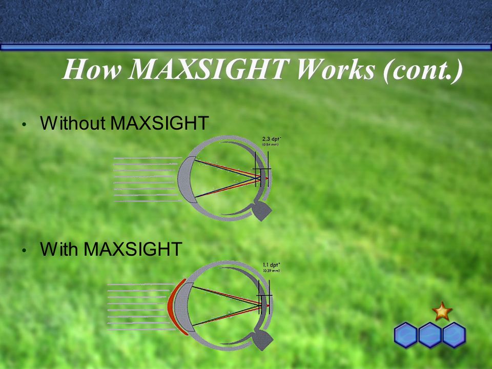 Nike MAXSIGHT Sport-Tinted Contact Lenses - ppt video online download