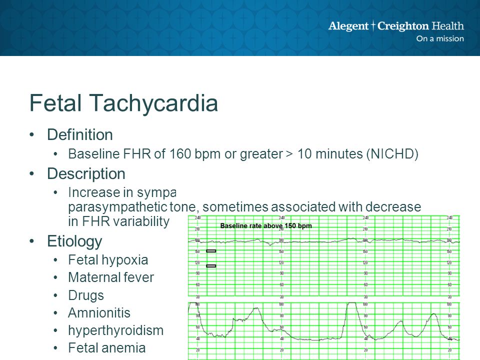Fetal Heart Rate Interpretation Ppt Video Online Download