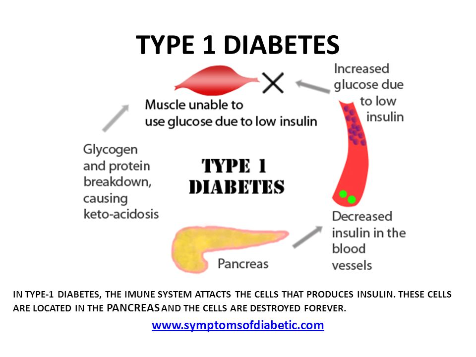 type 1 diabetes project)