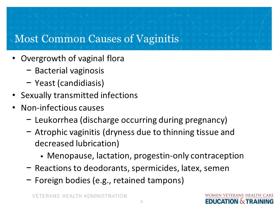 Causes of bacterial vaginal