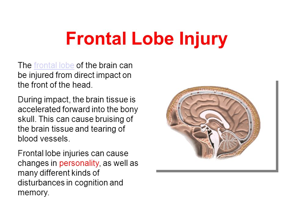 Traumatic Brain Injury Challenging Behavior Ppt Download Any injury, stroke, infection, tumor, or neurodegenerative disease that affects the brain. traumatic brain injury challenging