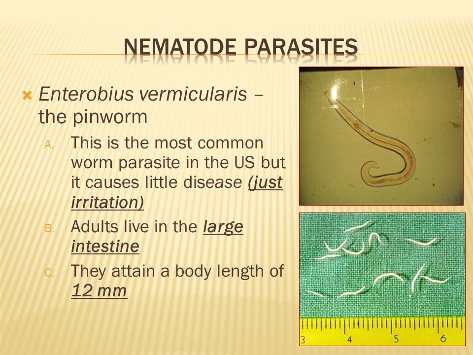 nematode enterobiasis