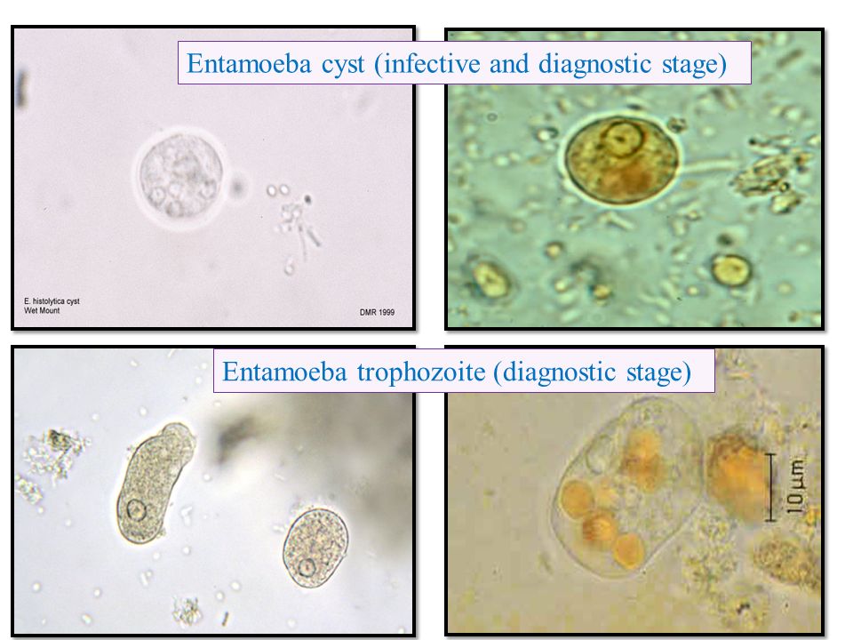 Entamoeba coli в кале. Entamoeba histolytica жизненный цикл. Entamoeba histolytica циста. Entamoeba histolytica микроскопия. Entamoeba histolytica диагностическая стадия.