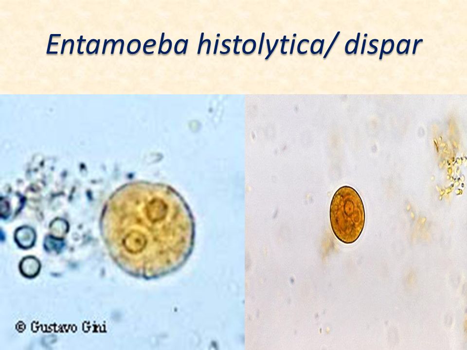 Entamoeba coli в кале. Entamoeba histolytica циста. Цисты Entamoeba. Entamoeba coli циста. Entamoeba histolytica под микроскопом.