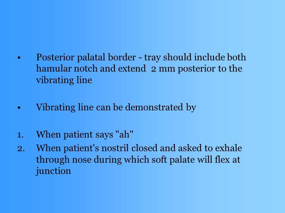 Posterior palatal border - tray should include both hamular notch and extend 2 mm posterior to the vibrating line