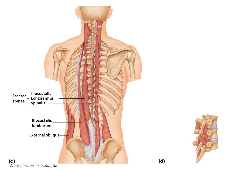 Болит мышца спины справа. Iliocostalis Lumborum. Longissimus Lumborum. Гипертонус поясничного отдела. Quadratus Lumborum.