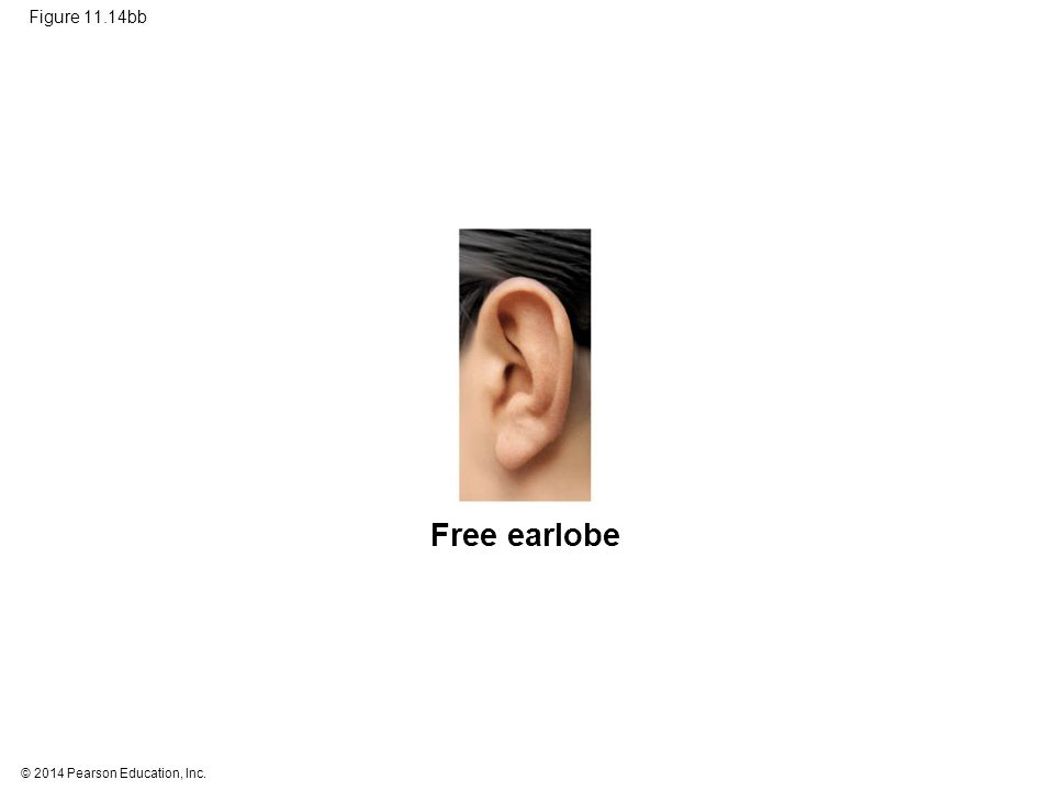 Figure 11.14bb Figure 11.14bb Pedigree analysis (part 2b: free earlobe photo) Free earlobe 63