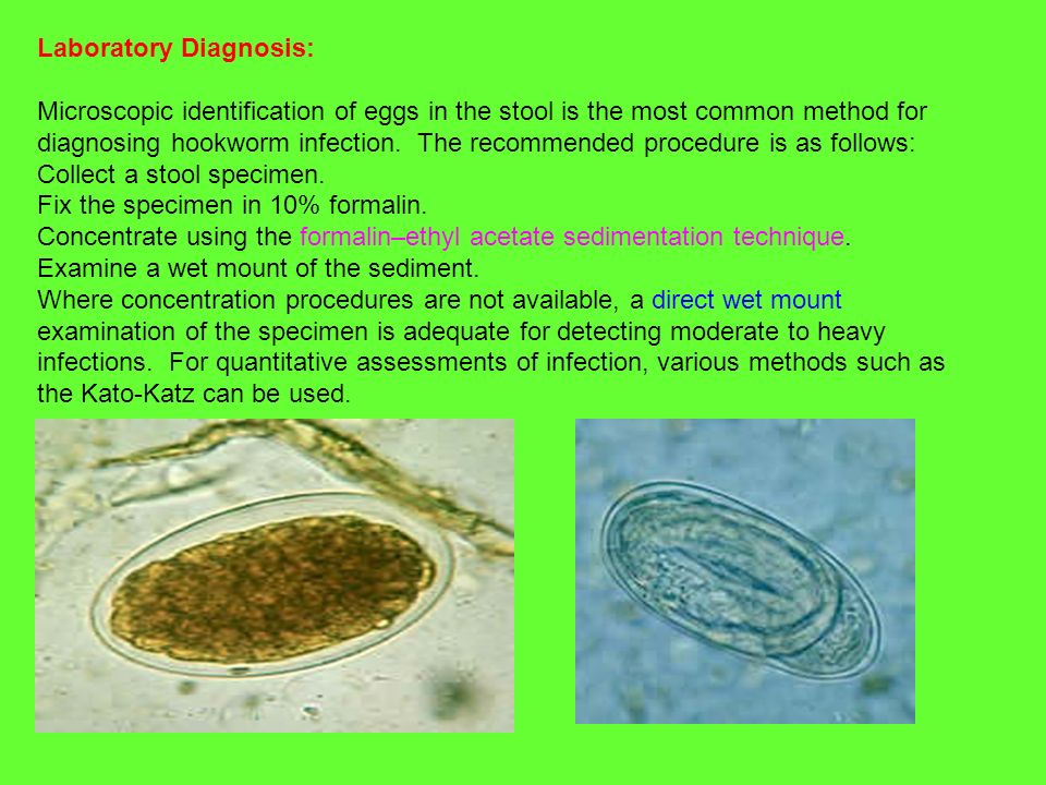 Ankilostomiasis tünetek kezelése gyermekeknél - Hookworm hookworm necatorosis