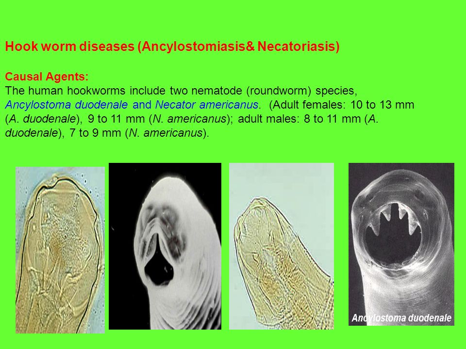 Hookworm hookworm necatorosis, A helminthiasis okai