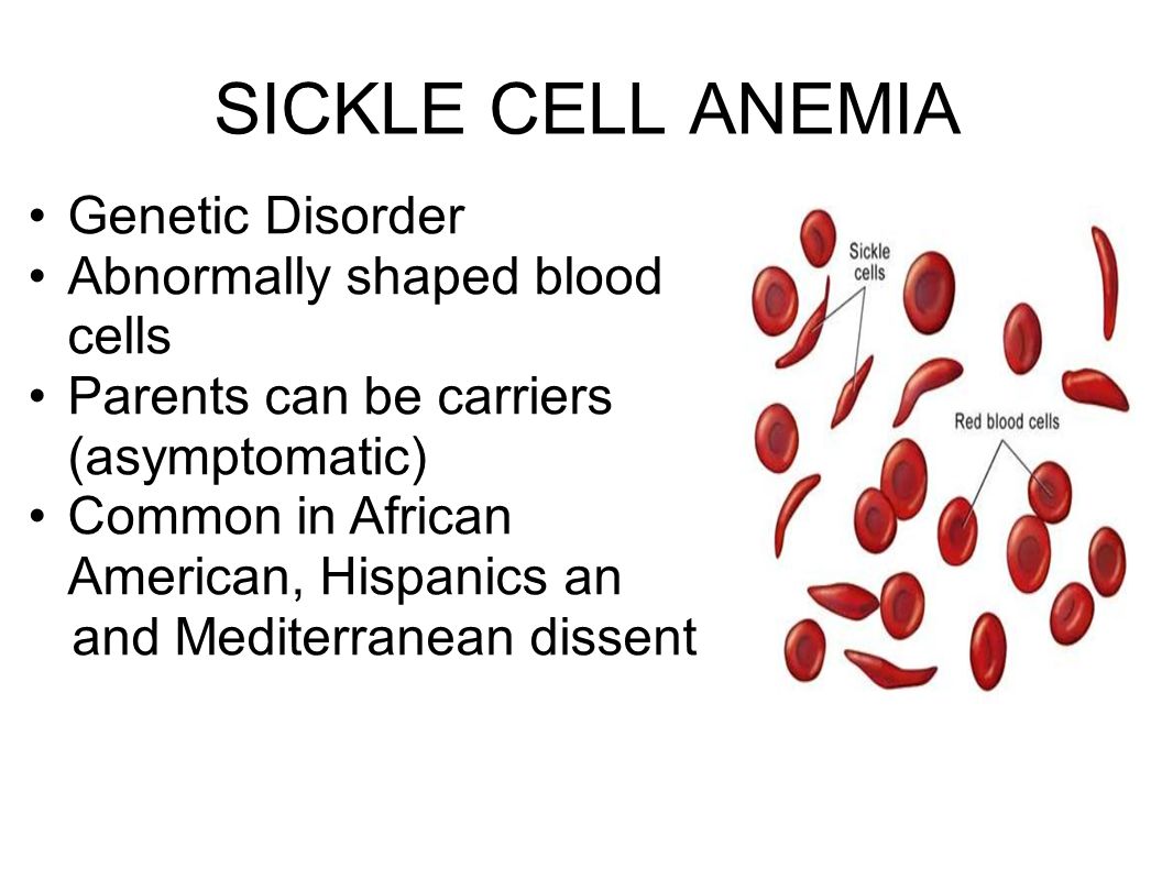 SICKLE CELL ANEMIA Genetic Disorder Abnormally shaped blood cells.