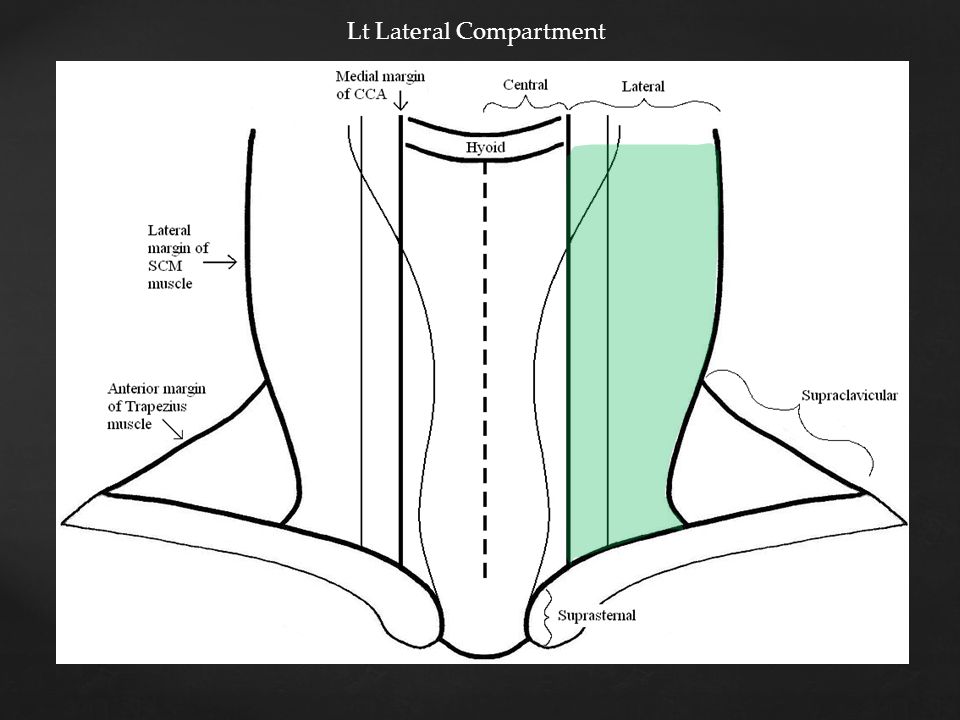 Lt Lateral Compartment
