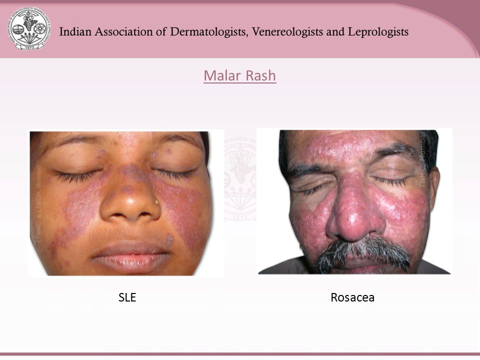Differential Diagnosis Ppt Video Online Download