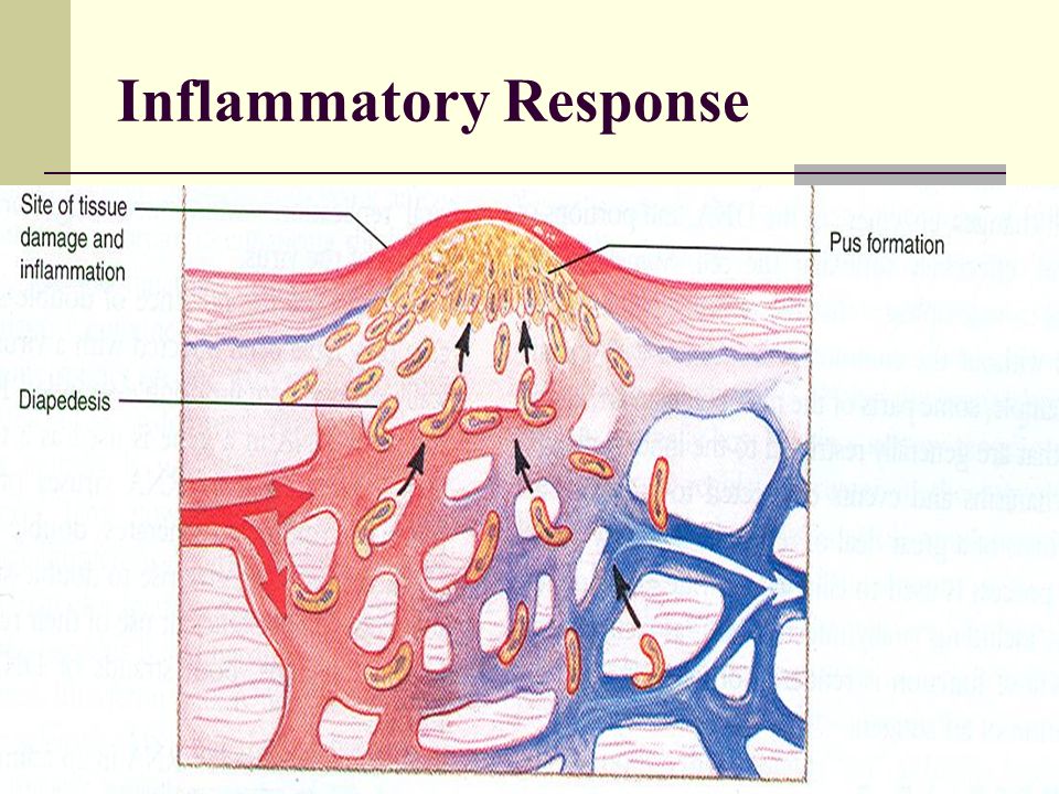Inflammatory Response.