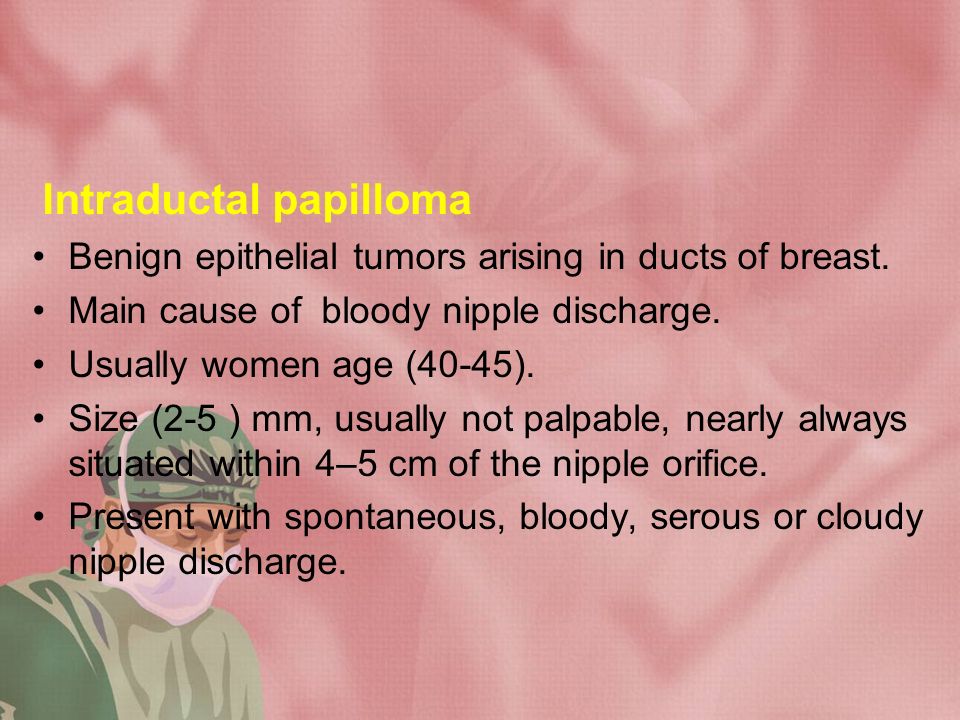 Papilloma vs granuloma. Intraductal papilloma with epithelial hyperplasia