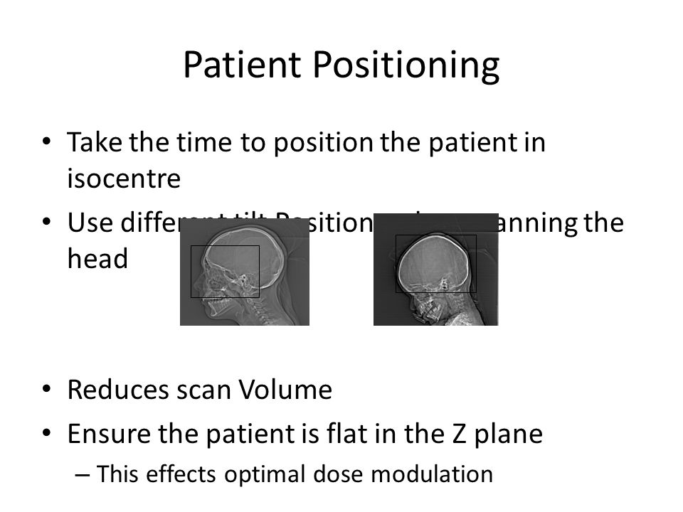 Patient Positioning Take the time to position the patient in isocentre