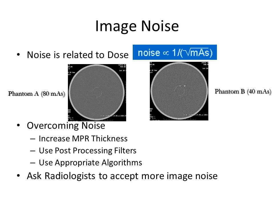 Image Noise Noise is related to Dose Overcoming Noise
