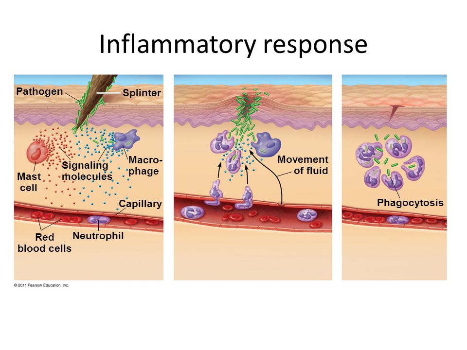 Inflammatory response.