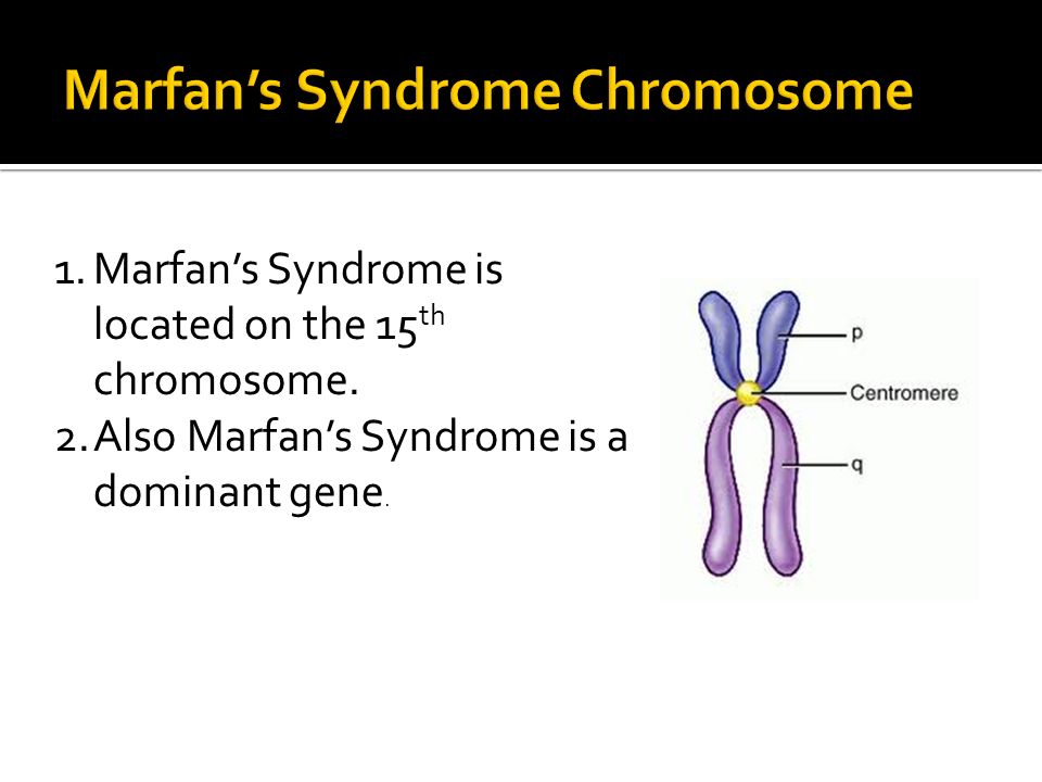 marfan syndrome mode of inheritance