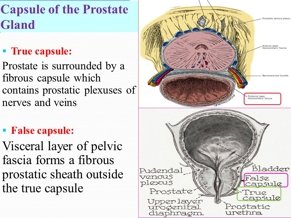 prostate gland capsule Krónikus stagnálás prosztatitis
