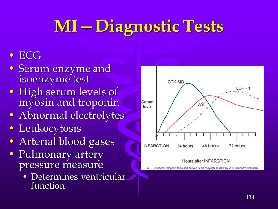 MI—Diagnostic Tests ECG Serum enzyme and isoenzyme test