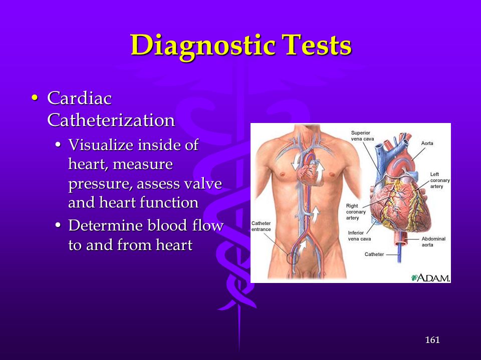 Diagnostic Tests Cardiac Catheterization