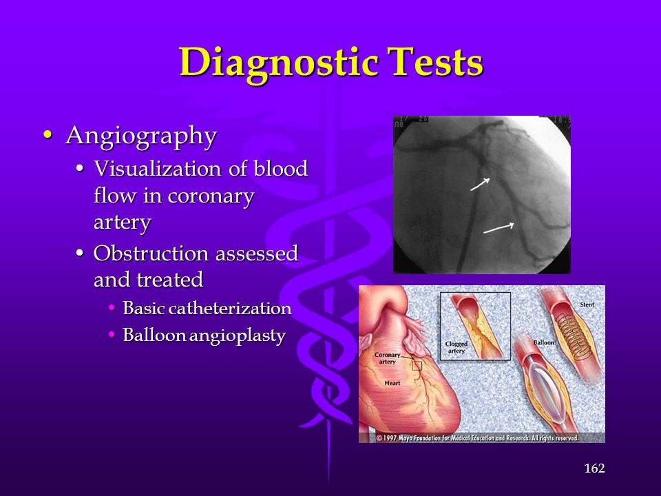Diagnostic Tests Angiography
