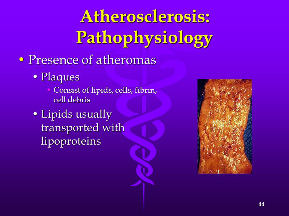 Atherosclerosis: Pathophysiology