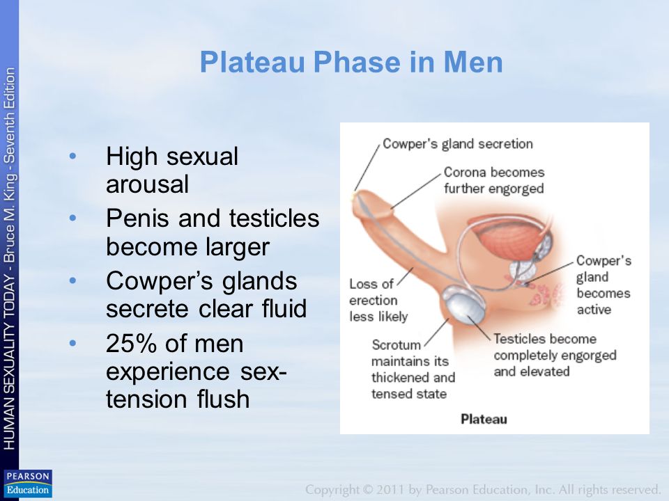 A Model For The Management Of Female Sexual Dysfunctions