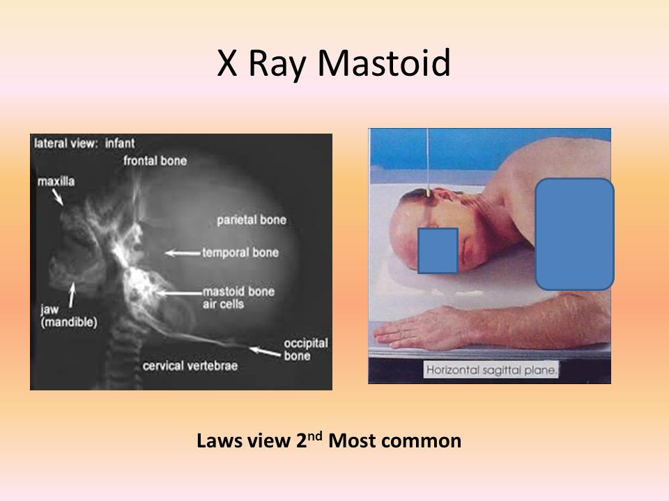Clinical Discussion Ear Ppt Video Online Download Clinical Discussion Ear Ppt Video Online Download