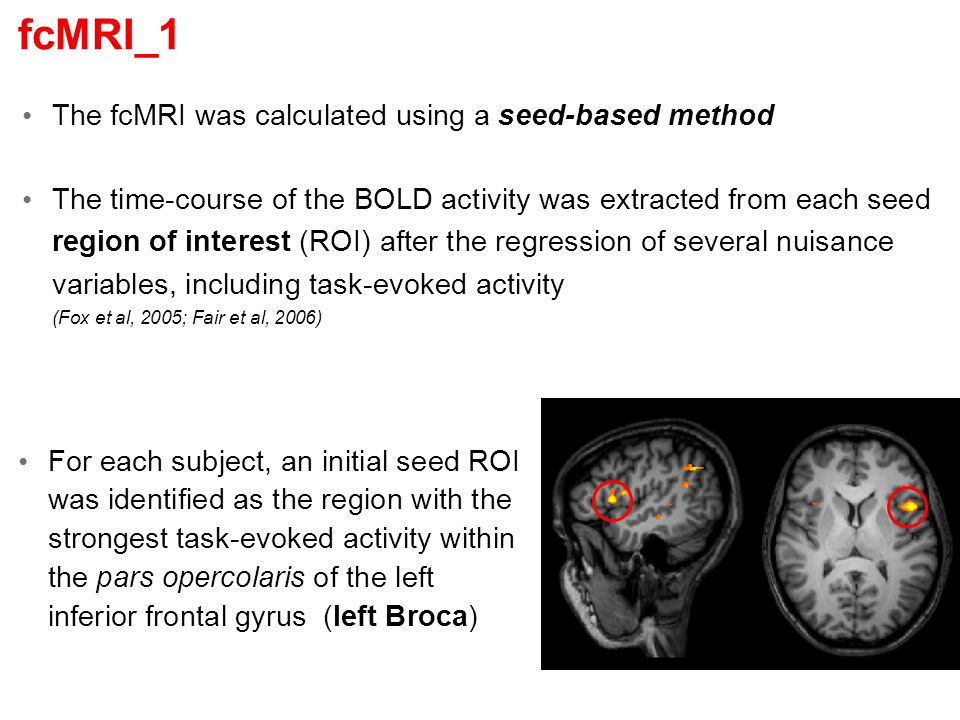 Functional Connectivity Mri In Patients With Brain Tumors Ppt Download Functional Connectivity Mri In Patients With Brain Tumors Ppt Download