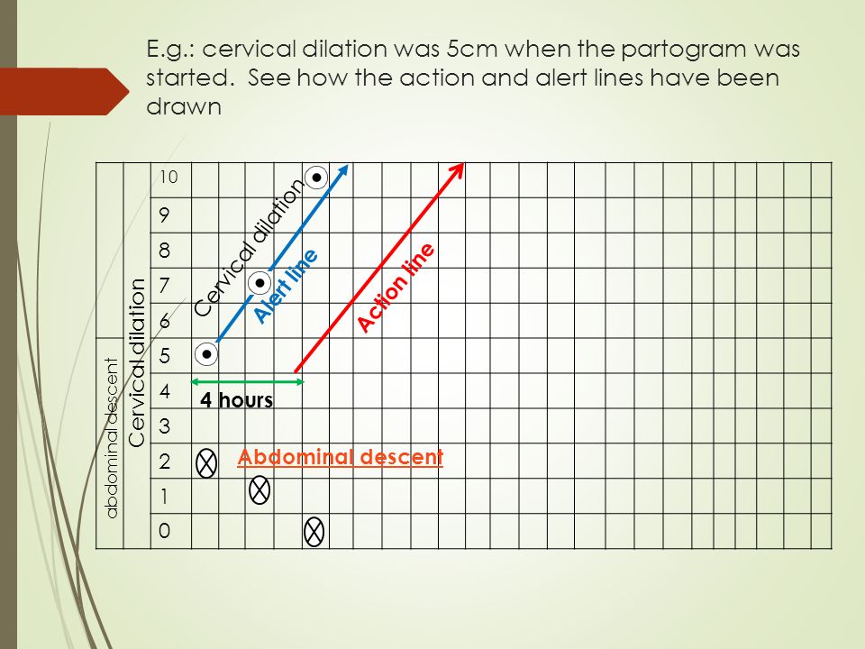 Partograph Chart Download